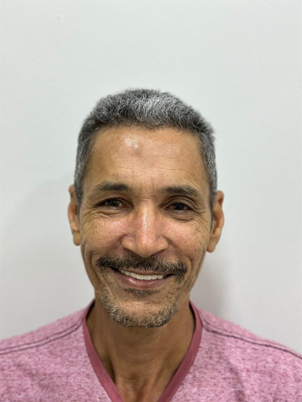O mesmo paciente depois da reabilitação, sorrindo com os dentes da frente restabelecidos.